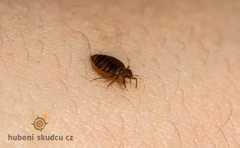 Jedna štěnice na lidské kůži v makro záběru.
